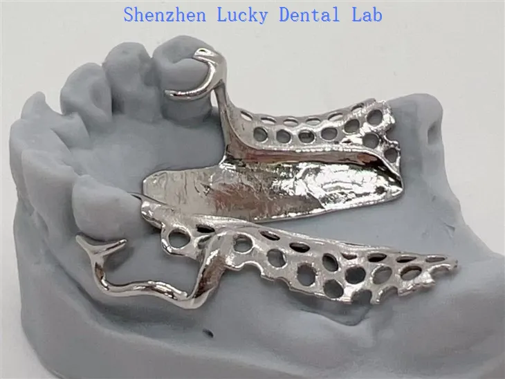 3D -Print China Dental Cocr Metall -Rahmenhersteller