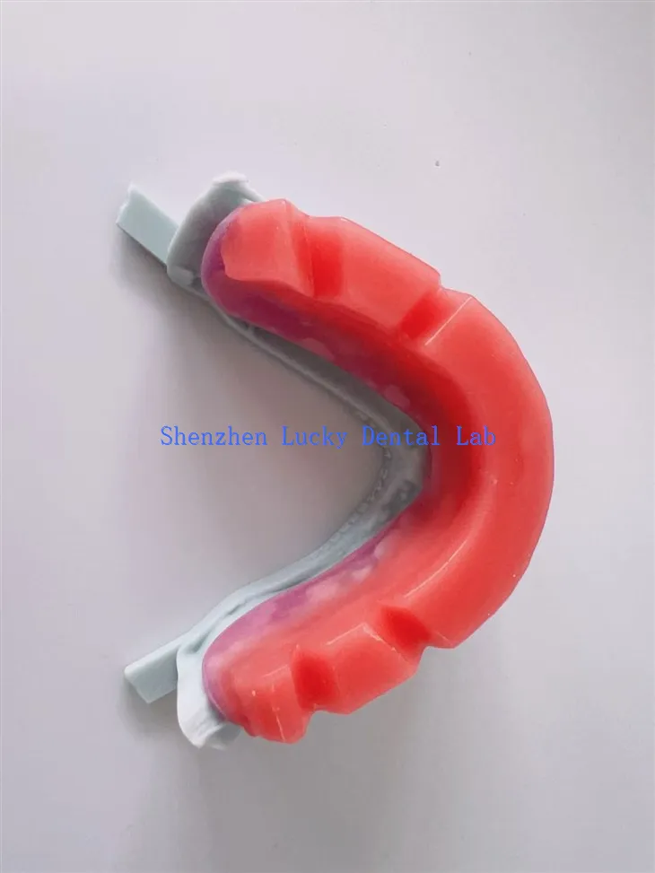 3D Print Dental Wax Rim Dental Lab