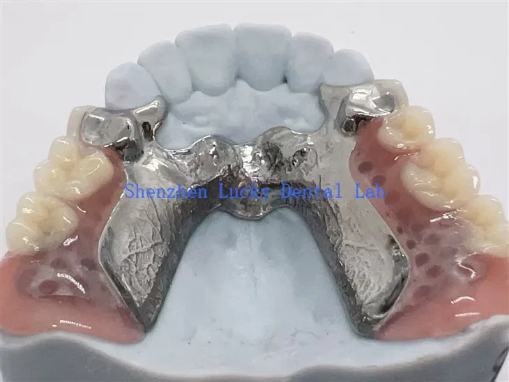 3D-Druckgerüst aus Titanlegierung