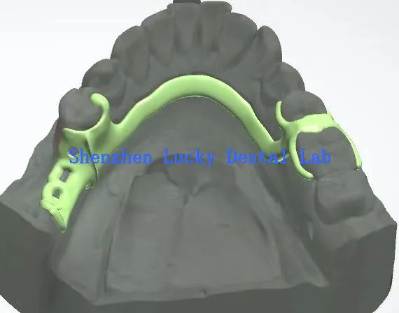 China 3D Print Dental Metal Framework Dental Lab
