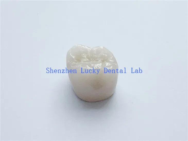 China Dental PFM Cocr Crown ohne Metallrand