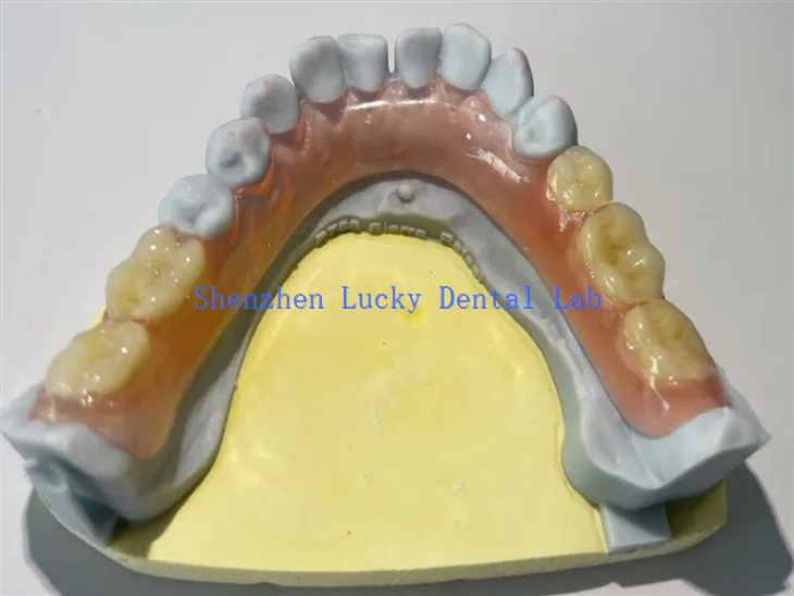 Bequeme partielle flexible Zahnprotokollhersteller