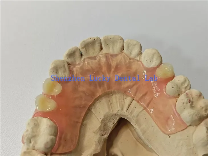 Komfortable flexible Zahnprothesen -Zahnarztlabor