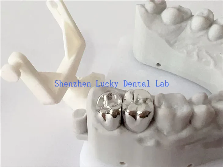 Dental Cocr Full Metall Crown Dental Lab