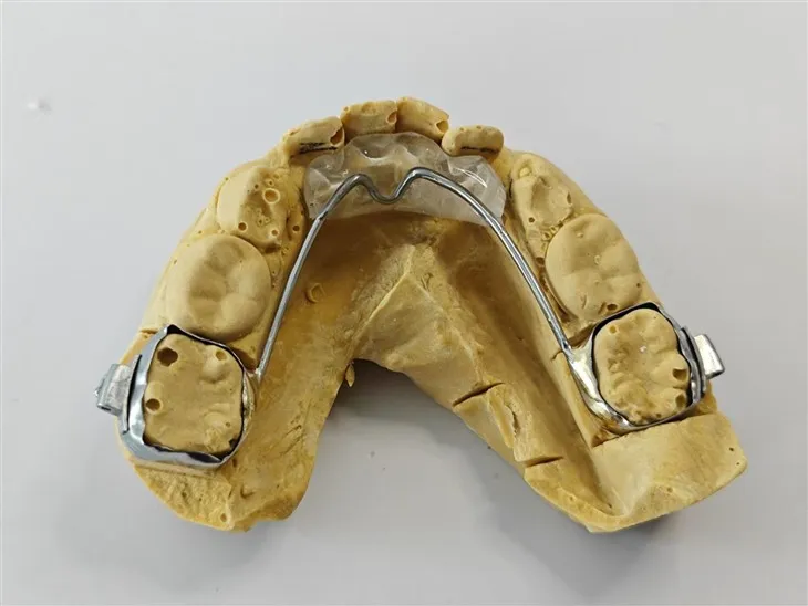 Zahnbissebene Zahn anterior