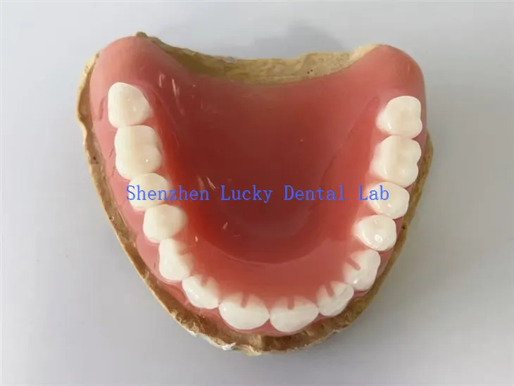 High-Quality Dental Full Acrylic Denture Made in China