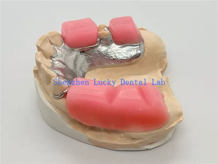 Metallrahmen mit Beißblock