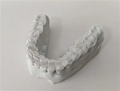 Klare Zahnbewegung mit Retainer