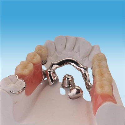 Starke Präzisions-Befestigungsbrücke